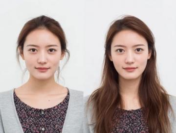 煙臺(tái)女子花費(fèi)6萬(wàn)元種植12顆牙兩年后全拆體重驟降引發(fā)熱議