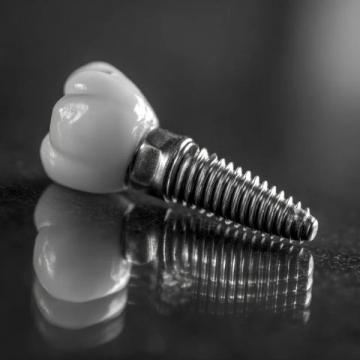 種植牙維護(hù)不用難(種植牙維護(hù)常識(shí))